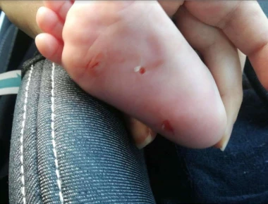 Αδιανόητο: Γυναίκα «χαρακώνει» μωρά στα νότια προάστια της Αθήνας!